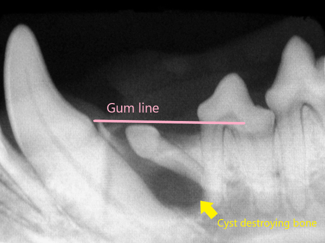 Oral cyst x-ray
